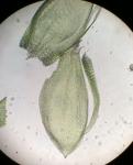 Bryoandersonia illecebra (Hedw.) H. Rob.