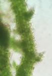 Cephaloziella spinicaulis Doulin