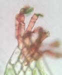 Hookeria acutifolia Hooker & Greville