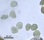 Phaeoceros carolinianus (Michx.) Prosk.